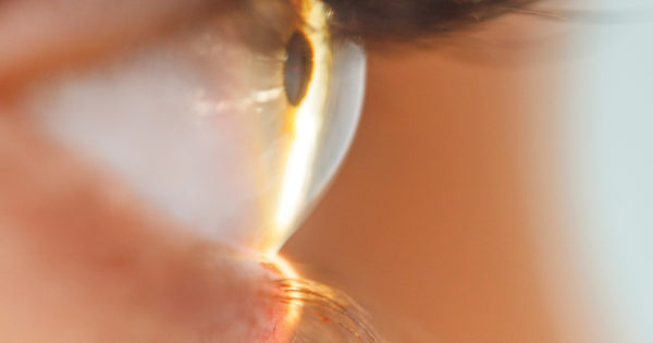 Neglet Visual Don’t Neglect Visual Function | CollaborativeEYE
